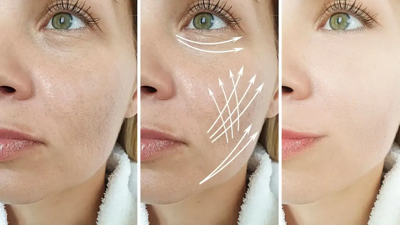 Can One Treatment Really Tackle More Than One Skin Concern Owsestry?