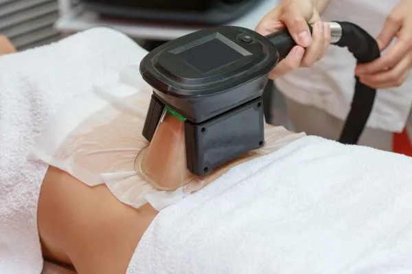 Image of person having fat freezing treatment to help weight gain Owsestry