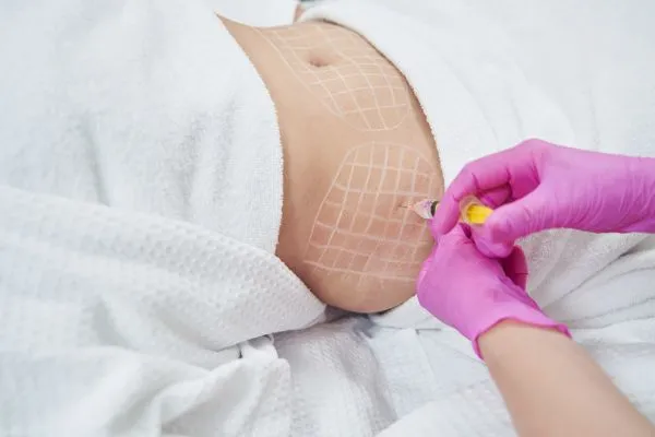 image of fat dissolving injections on love handles to help combat weight gain Owsestry