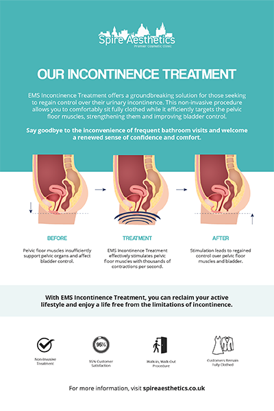 image to show how EMS treatment works for female urinary incontinence Owsestry