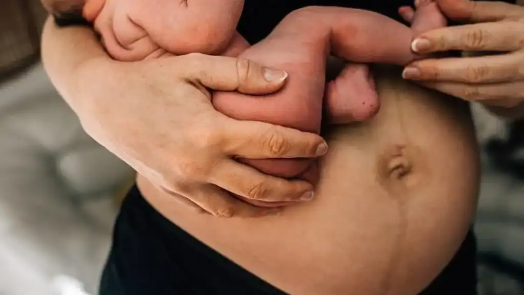 Why Is My Stomach Still Big After Pregnancy Owsestry?